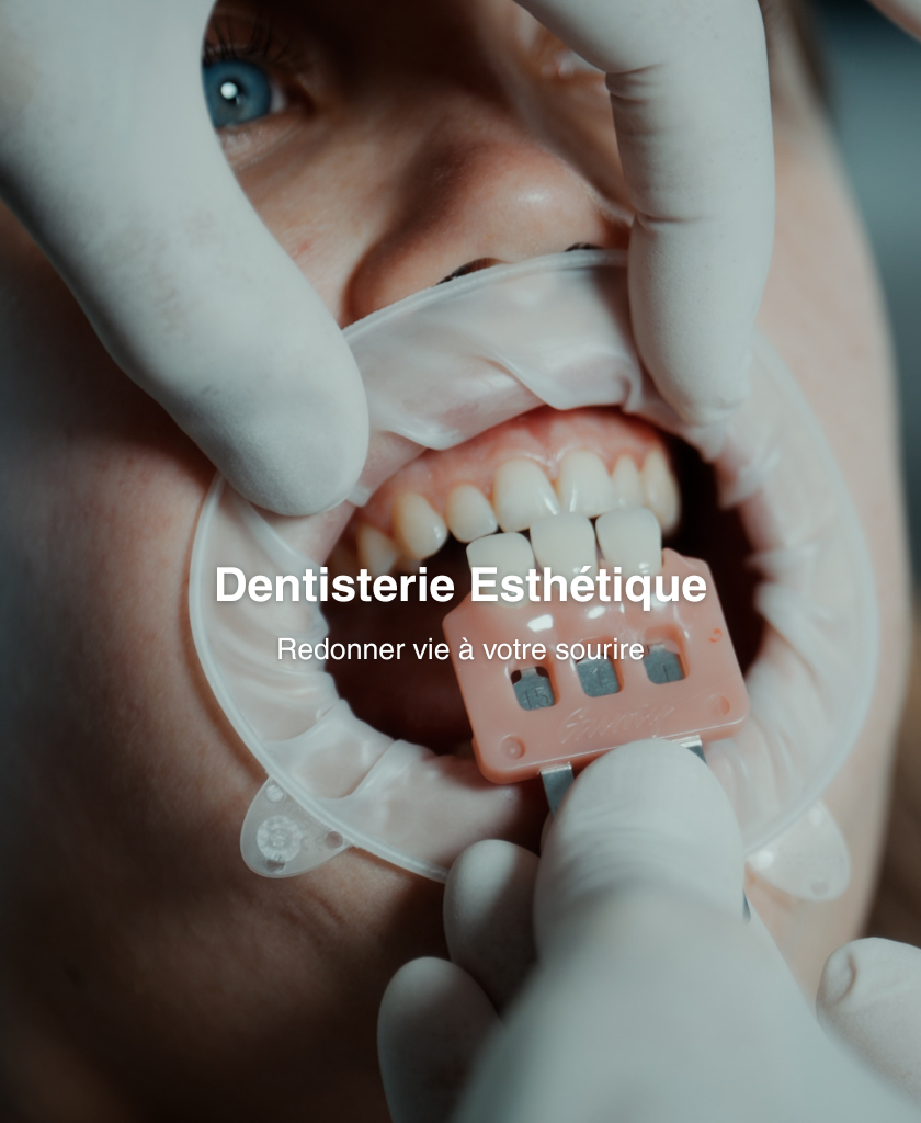 esthetique