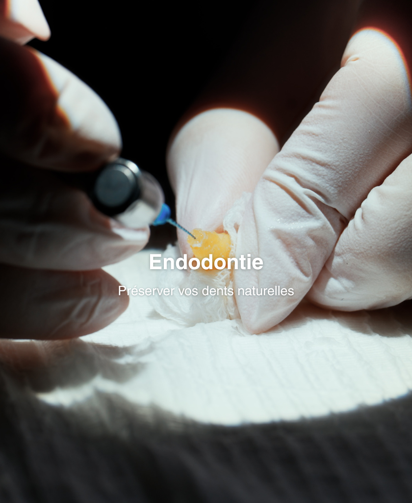 Endodontie_2