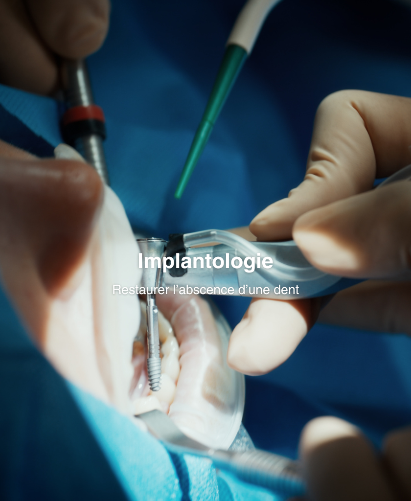 Implantologie_2